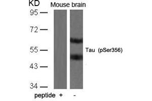 Western blot analysis of extracts from mouse brain tissue using Tau(Phospho-Ser356) Antibody and the same antibody preincubated with blocking peptide. (MAPT Antikörper  (pSer356))