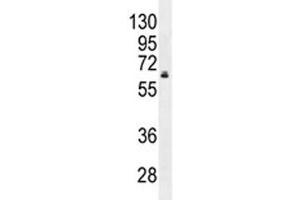HNF1B antibody western blot analysis in MDA-MB231 lysate. (HNF1B Antikörper  (AA 498-529))