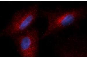 Immunofluorescence (IF) image for anti-Complement Factor Bb antibody (PE) (ABIN5564992) (Complement Factor Bb Antikörper  (PE))