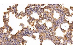 Immunohistochemistry (IHC) image for anti-Transferrin (TF) antibody (ABIN7430009)