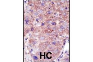 Immunohistochemistry (Paraffin-embedded Sections) (IHC (p)) image for anti-SMAD Specific E3 Ubiquitin Protein Ligase 2 (SMURF2) (AA 702-731), (C-Term) antibody (ABIN388831)