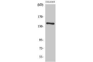 Western Blotting (WB) image for anti-Collagen, Type II, alpha 1 (COL2A1) (N-Term) antibody (ABIN3174482) (COL2A1 Antikörper  (N-Term))