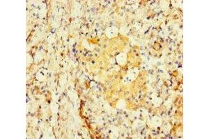 Immunohistochemistry of paraffin-embedded human pancreatic tissue using ABIN7171622 at dilution of 1:100 (TBC1D24 Antikörper  (AA 1-169))
