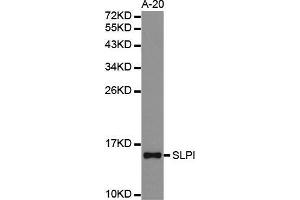 Western blot analysis of extracts of A-20 cell lines, using SLPI antibody. (SLPI Antikörper  (AA 26-132))