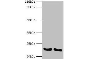 Western blot All lanes: IFNA14 antibody at 2 μg/mL Lane 1: A549 whole cell lysate Lane 2: Mouse heart tissue Secondary Goat polyclonal to rabbit IgG at 1/10000 dilution Predicted band size: 23 kDa Observed band size: 23 kDa (IFNa14 Antikörper  (AA 24-189))