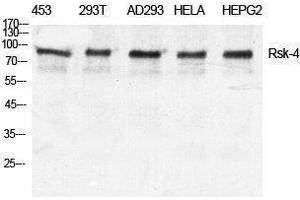 Western Blotting (WB) image for anti-Ribosomal Protein S6 Kinase, 90kDa, Polypeptide 6 (RPS6KA6) (C-Term) antibody (ABIN3177309) (RPS6KA6 Antikörper  (C-Term))