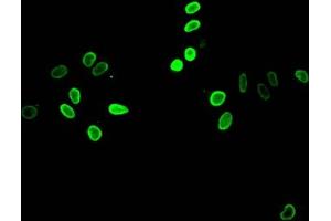 Immunofluorescent analysis of Hela cells treated by NaB using ABIN7139153 at dilution of 1:100 and Alexa Fluor 488-congugated AffiniPure Goat Anti-Rabbit IgG(H+L) (HIST1H4A Antikörper  (acLys12))