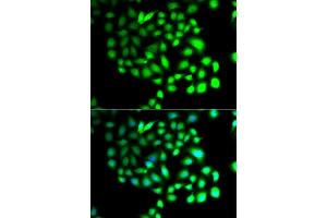 Immunofluorescence analysis of A549 cells using TCEAL8 antibody (ABIN5974946). (TCEAL8 Antikörper)