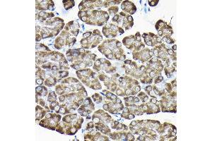 Immunohistochemistry of paraffin-embedded mouse pancreas using RPS15A Rabbit pAb (ABIN6131092, ABIN6147201, ABIN6147202 and ABIN6214414) at dilution of 1:200 (40x lens). (RPS15A Antikörper  (AA 1-130))