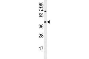AMACR antibody western blot analysis in MDA-MB231 lysate (AMACR Antikörper  (AA 323-351))