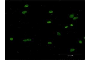 Immunofluorescence of monoclonal antibody to CRY1 on HeLa cell. (CRY1 Antikörper  (AA 1-586))