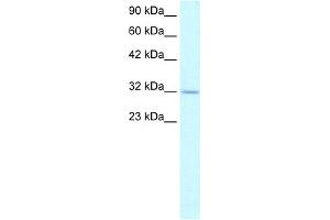 WB Suggested Anti-APEX1 Antibody Titration:  1. (APEX1 Antikörper  (N-Term))