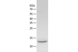 Western Blotting (WB) image for Chemokine (C-C Motif) Ligand 25 (CCL25) (AA 24-150) protein (His tag) (ABIN7122291) (CCL25 Protein (AA 24-150) (His tag))