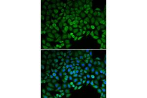 Immunofluorescence (IF) image for anti-Catenin (Cadherin-Associated Protein), delta 1 (CTNND1) (AA 573-832) antibody (ABIN3022309) (CTNND1 Antikörper  (AA 573-832))