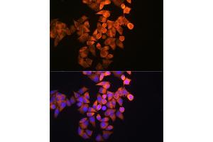 Immunofluorescence analysis of HeLa cells using RRM1 Rabbit pAb (ABIN3021562, ABIN3021563, ABIN3021564 and ABIN6215245) at dilution of 1:100 (40x lens). (RRM1 Antikörper  (AA 593-792))