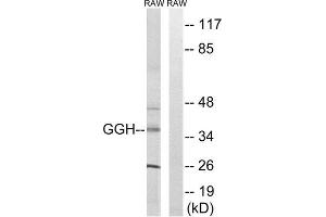 Western Blotting (WB) image for anti-gamma-Glutamyl Hydrolase (Conjugase, Folylpolygammaglutamyl Hydrolase) (GGH) (C-Term) antibody (ABIN1851354) (GGH Antikörper  (C-Term))