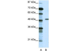 WB Suggested Anti-TADA3L Antibody Titration: 0. (TADA3L Antikörper  (Middle Region))