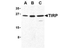 Image no. 2 for anti-Toll-Like Receptor Adaptor Molecule 2 (TICAM2) (C-Term) antibody (ABIN204200)