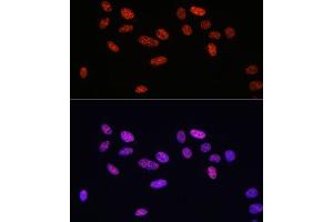 Immunofluorescence analysis of U2OS cells using Phospho-Smad2-S465/467 + Smad3-S423/425 antibody (ABIN6135314, ABIN6136248, ABIN6136249 and ABIN6225575) at dilution of 1:100. (SMAD2 / SMAD3 (pSer423), (pSer425) Antikörper)