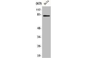 Western Blot analysis of 293 cells using BACH1 Polyclonal Antibody (BACH1 Antikörper  (Internal Region))