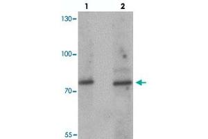 Western blot analysis of JAKMIP1 in rat brain tissue with JAKMIP1 polyclonal antibody  at (lane 1) 1 and (lane 2) 2 ug/mL. (JAKMIP1 Antikörper  (Internal Region))