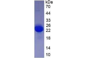 SDS-PAGE analysis of recombinant Rat VEGFA. (VEGFA Protein)