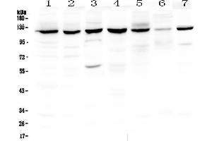 Western blot analysis of PARP using anti-PARP antibody . (PARP1 Antikörper  (AA 670-858))