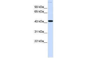 WB Suggested Anti-YBX2 Antibody Titration:  0. (YBX2 Antikörper  (N-Term))