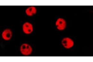 ABIN6278639 staining Hela by IF/ICC. (TAL1 Antikörper  (C-Term))