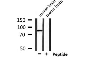 Western blot analysis of extracts from mouse brain, using TMC7 Antibody. (TMC7 Antikörper  (C-Term))