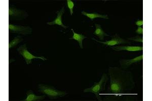 Immunofluorescence of purified MaxPab antibody to IRF5 on HeLa cell. (IRF5 Antikörper  (AA 1-498))