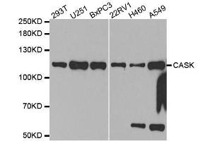 Western blot analysis of extracts of various cell lines, using CASK antibody.