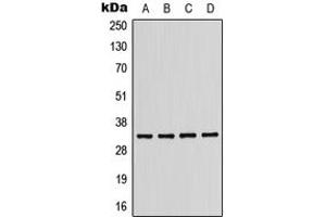Western Blotting (WB) image for anti-Killer Cell Immunoglobulin-Like Receptor, Two Domains, Long Cytoplasmic Tail, 2 (KIR2DL2) (Center) antibody (ABIN7296122)