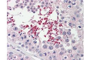 Image no. 1 for anti-ATP-Binding Cassette, Sub-Family D (ALD), Member 2 (Abcd2) (AA 338-558) antibody (ABIN467567) (Abcd2 Antikörper  (AA 338-558))