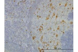 Image no. 4 for anti-Aldo-Keto Reductase Family 1, Member A1 (Aldehyde Reductase) (AKR1A1) (AA 1-326) antibody (ABIN599129) (AKR1A1 Antikörper  (AA 1-326))