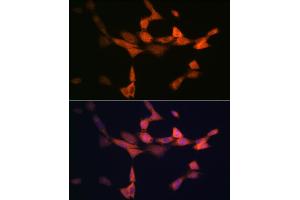Immunofluorescence analysis of NIH-3T3 cells using PIK3R4/VPS15 Rabbit mAb (ABIN7269322) at dilution of 1:100 (40x lens). (PIK3R4 Antikörper)