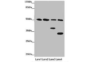 Western blot All lanes: B7H6 antibody at 2 μg/mL Lane 1: Mouse heart tissue Lane 2: Mouse liver tissue Lane 3: Mouse brain tissue Lane 4: Hela whole cell lysate Secondary Goat polyclonal to rabbit IgG at 1/10000 dilution Predicted band size: 51 kDa Observed band size: 51, 38, 32 kDa (B7-H6 Antikörper  (AA 25-262))