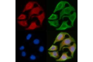 ABIN6263354 and ABIN6278592 staining Hela cells by IF/ICC. (MRGPRX4 Antikörper  (C-Term))