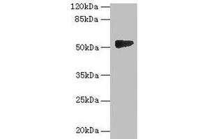 Western blot All lanes: GTDC1 antibody at 4 μg/mL + A549 whole cell lysate Secondary Goat polyclonal to rabbit IgG at 1/10000 dilution Predicted band size: 53, 44, 34, 50, 38 kDa Observed band size: 53 kDa (GTDC1 Antikörper  (AA 1-292))