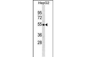 Western blot analysis in HepG2 cell line lysates (35ug/lane). (ZNF101 Antikörper  (AA 122-148))