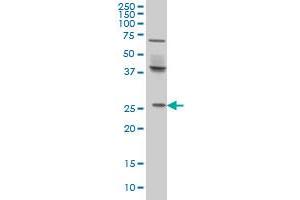 Western Blotting (WB) image for anti-PRELI Domain Containing 1 (PRELID1) (AA 3-101) antibody (ABIN599217) (PRELID1 Antikörper  (AA 3-101))