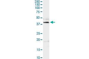 ADA MaxPab rabbit polyclonal antibody. (ADA Antikörper  (AA 1-363))