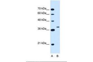 Image no. 1 for anti-Ring Finger Protein 146 (RNF146) (C-Term) antibody (ABIN320783) (RNF146 Antikörper  (C-Term))
