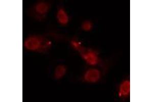 ABIN6275327 staining  MCF7 cells by IF/ICC.