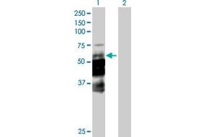 Western Blot analysis of DCP1A expression in transfected 293T cell line by DCP1A MaxPab polyclonal antibody. (DCP1A Antikörper  (AA 1-582))
