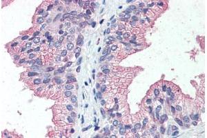 Immunohistochemistry (IHC) image for anti-Solute Carrier Family 39 (Zinc Transporter), Member 14 (SLC39A14) (Internal Region) antibody (ABIN960808)