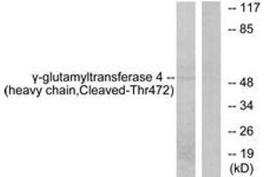 Western blot analysis of extracts from Jurkat cells, treated with etoposide 25uM 24h, using Gamma-glutamyltransferase 4 (heavy chain,Cleaved-Thr472) Antibody. (GGT7 Antikörper  (Cleaved-Thr472))
