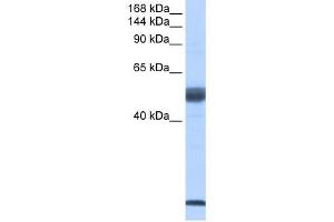 WB Suggested Anti-SF3B14 Antibody Titration:  0. (Pre-mRNA Branch Site Protein p14 (SF3B14) (Middle Region) Antikörper)