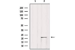 Western blot analysis of extracts from Rat lung, using TNFAIP8L1 Antibody. (TNFAIP8L1 Antikörper  (Internal Region))