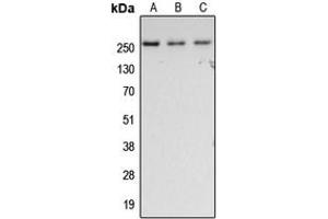 Western blot analysis of Fibronectin expression in HeLa (A), SP2/0 (B), rat lung (C) whole cell lysates. (Fibronectin Antikörper  (C-Term))